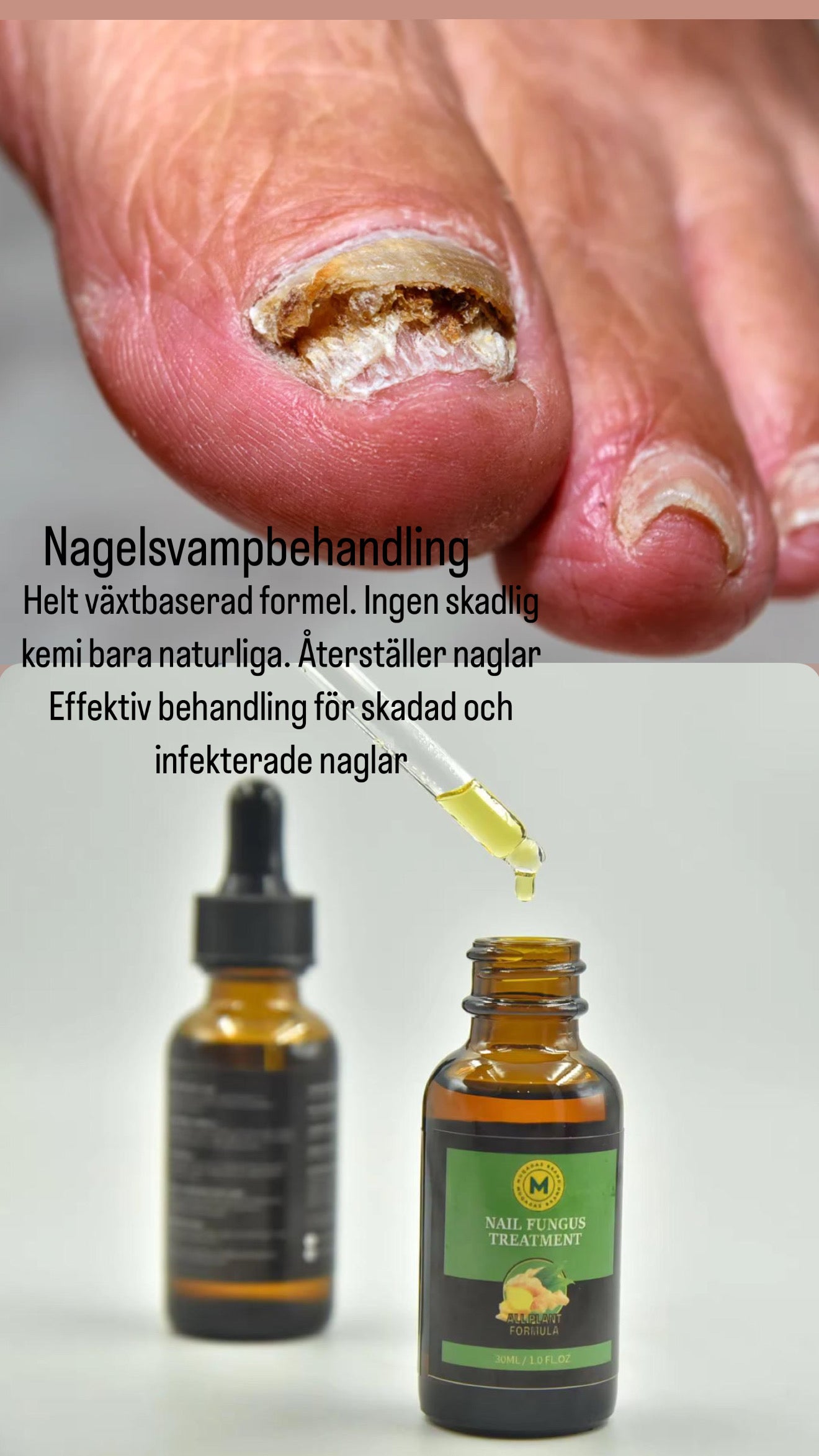 Nail fungus treatment