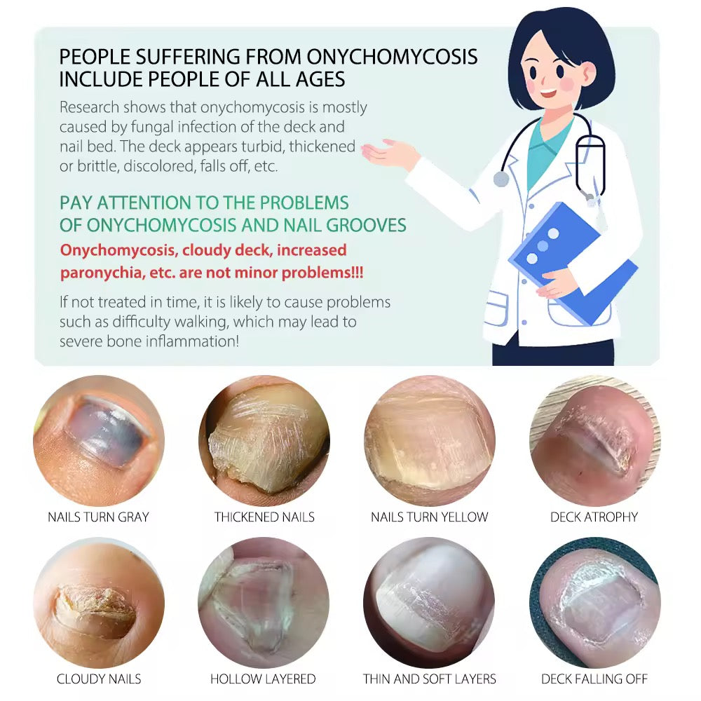 Nail fungus treatment